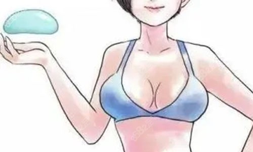 假体隆胸的动画图