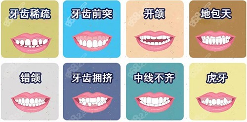牙齿矫正不同适应症漫画图