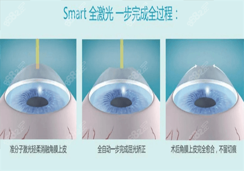 acf204108d0b1955859cd4d841414ed.png