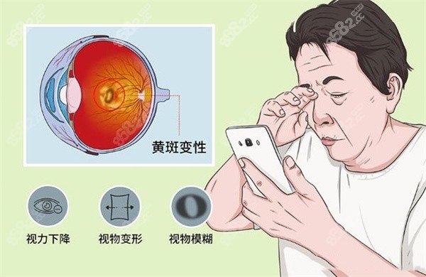 视疲劳