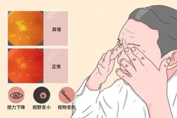 揉眼睛