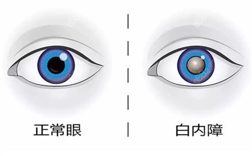 眼部对比