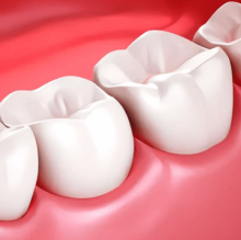 牙齿松动有几个等级？不同等级的牙齿松动应该如何补救呢