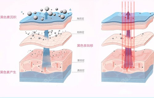 皮肤美白内部作用层次示意图.jpg