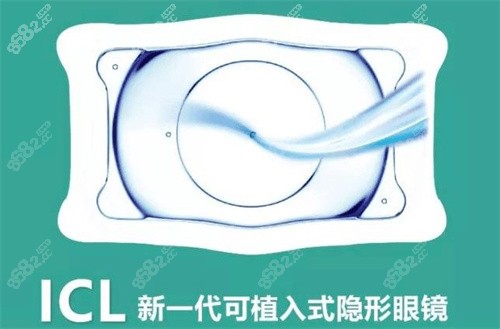 ICL人工晶体植入术