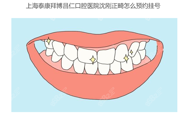 上海泰康拜博昌仁口腔医院沈刚正畸怎么预约挂号