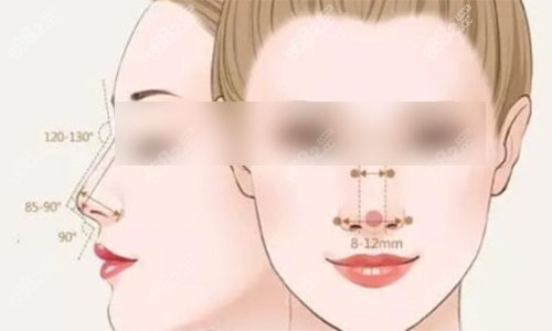 隆鼻手術(shù)美學標準圖