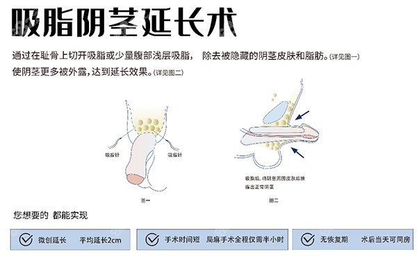 李世荣医生做男科手术怎么样