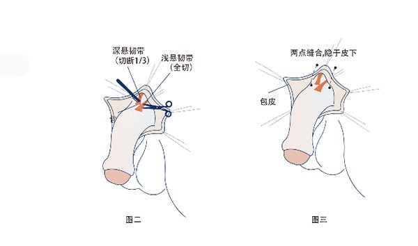 李世荣医生做男科手术怎么样