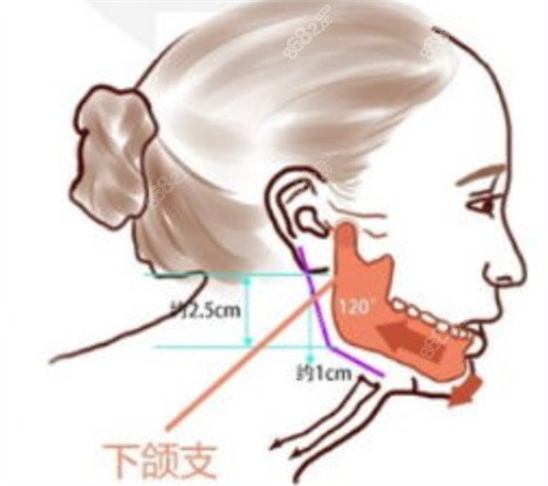 成都东篱医院磨骨手术费用超低价可享