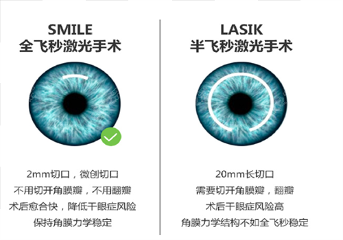 晶体植入近视眼手术和全飞秒哪个好