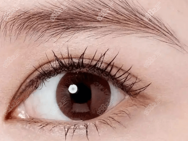 角膜塑形镜控制视力增长