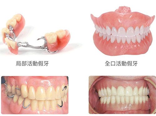 唐河县牙科诊所哪家好？唐河看牙这五家牙科值得一去！