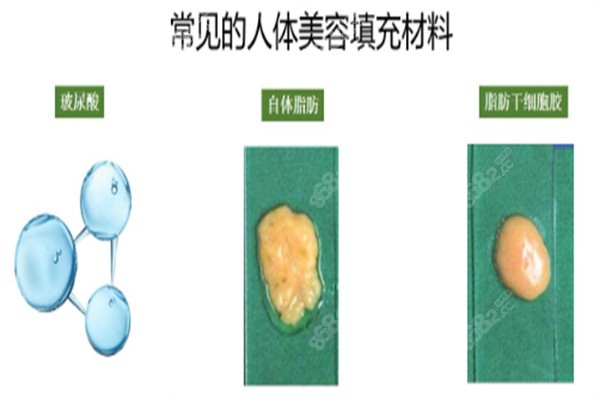 陈德法自提脂肪隆胸存活率