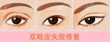 上海修复双眼皮在哪个医院？在上海安禾美阁 上海预约指南/联系方式