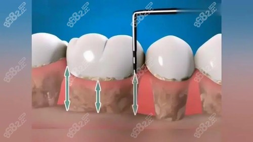 含山县牙科诊所哪家好？推荐五家 大家看牙可以对比看看！