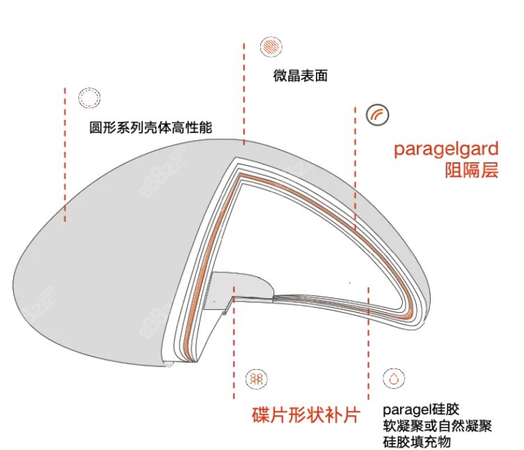 优丝俪假体优势