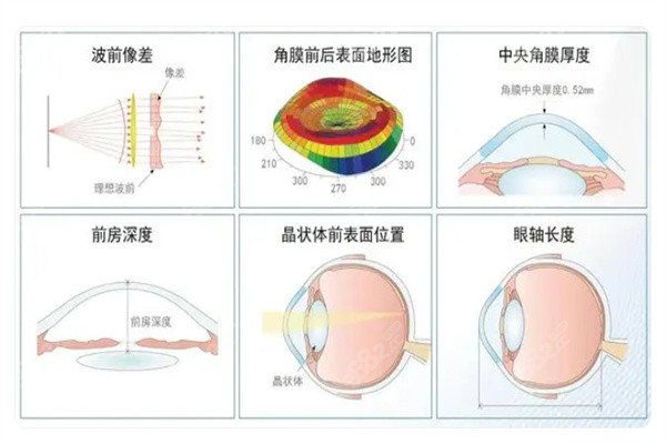 全光塑屈光矫正手术上市了吗