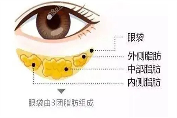 深圳祛眼袋医生排行榜