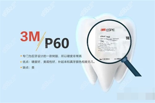 3MP60树脂材料示意图