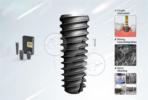 登特斯种植牙植体设计.jpg