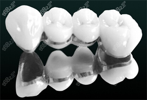 昆明柏德口腔做烤瓷牙技术成熟