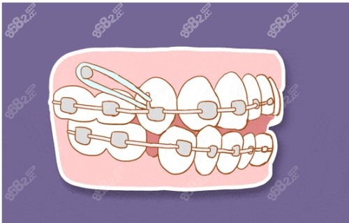 广州曙光美云口腔牙齿矫正技术不错 广州曙光美云口腔牙齿矫正技术不错