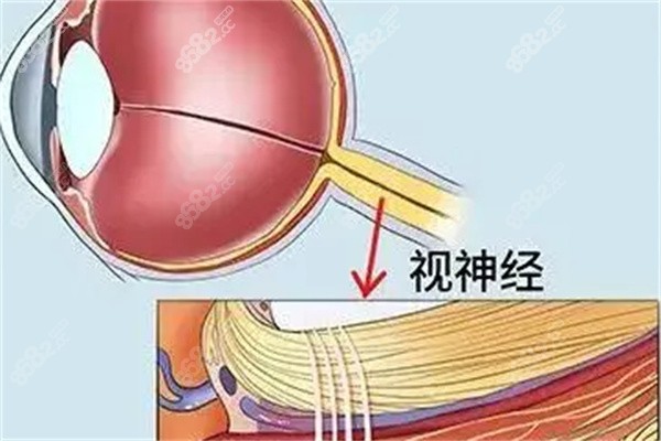 视神经萎缩手术