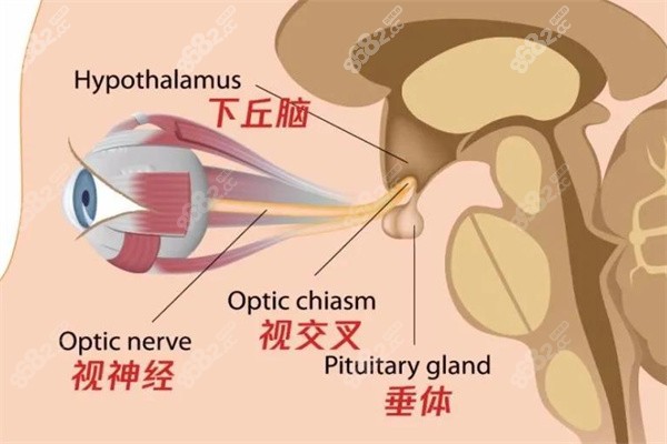 视神经萎缩手术多少钱