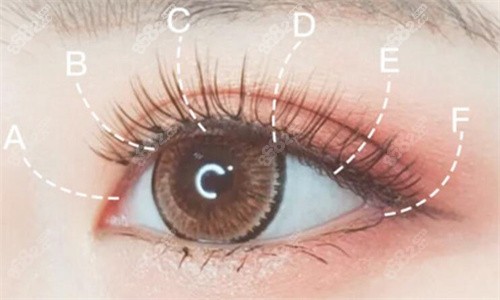 宋貴霞醫(yī)生做雙眼皮怎么樣？