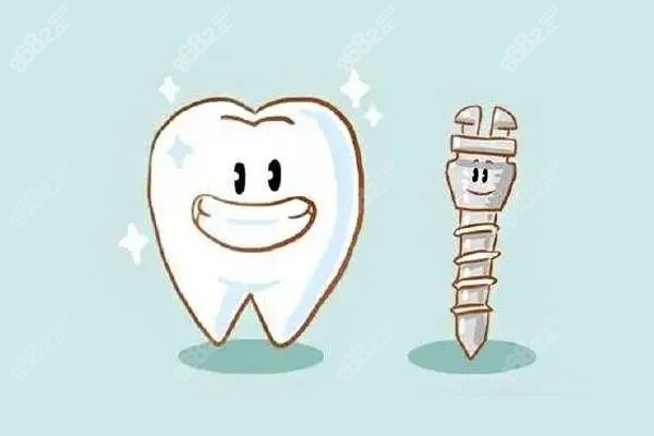 種植牙和裝假牙哪個好