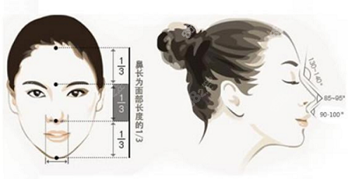 甄永环医生隆鼻技术优势