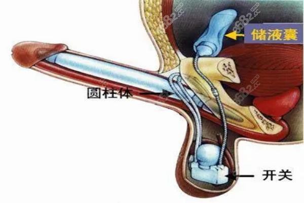 男性障碍怎么治疗