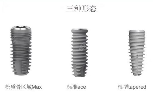 株洲乐莎莎口腔医院种植牙技术成熟