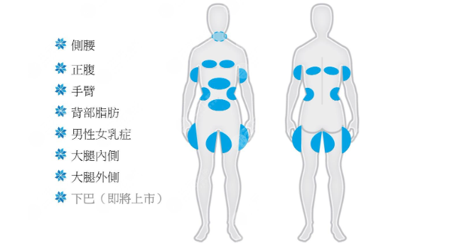 宋新吸脂减肥技术