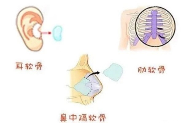 沈阳王滨福做鼻子怎么样