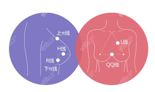 广州尹卫东隆胸技术稳定靠谱实例多 广州尹卫东隆胸技术稳定靠谱实例多