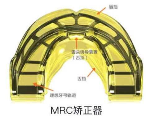 珠海九龙口腔MRC儿童早期矫治6000元起,帮助孩子颌发育