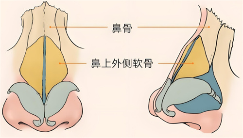 深圳皇佳亿美整形2024价格公布：鼻假体修复1.68w+