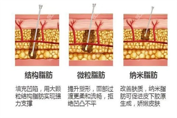 北京王明利博士病例