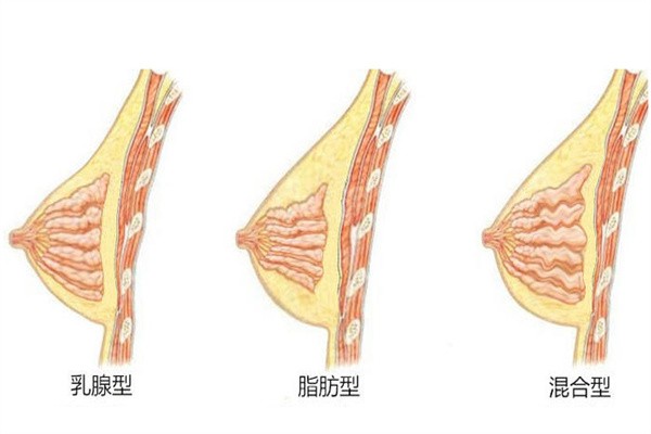 北京王明利丰胸病例