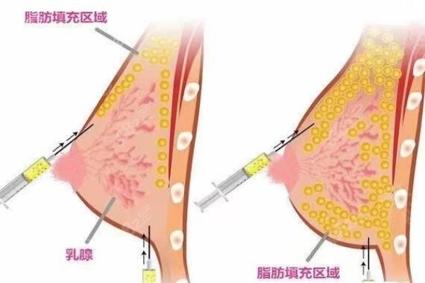 北京纯脂医疗美容预约挂号指南：冯斌/孙泽芳/王自谦吸脂一键预约