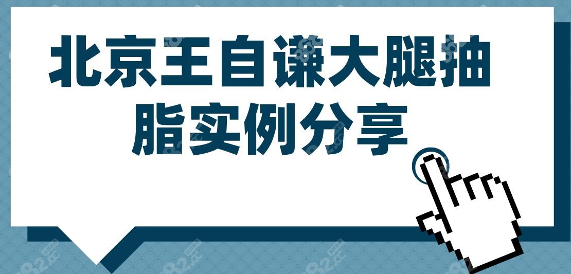 北京王自谦大腿抽脂实例分享