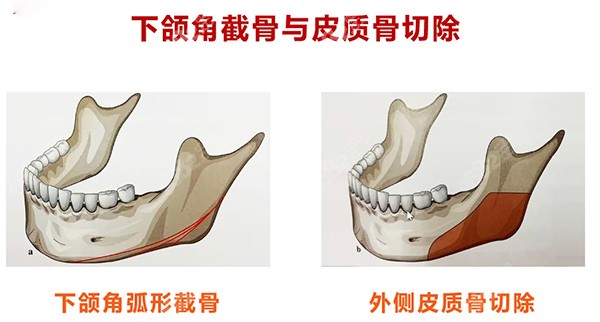 李继华和罗恩