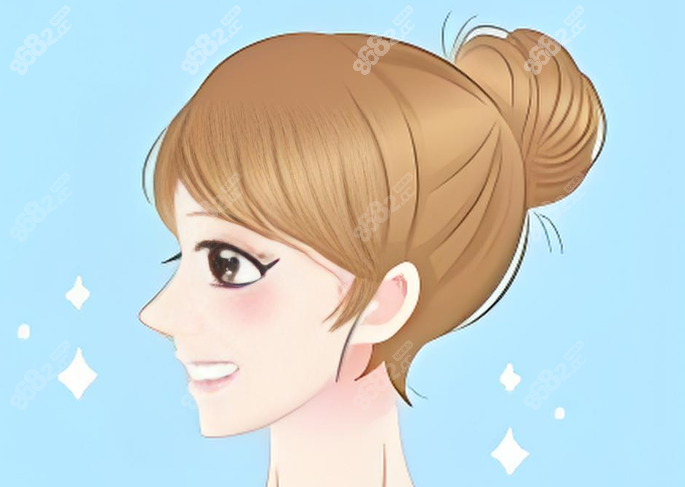 温州星范金江峰鼻失败修复实例分析