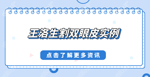 王洛生割双眼皮实例:王洛生做双眼皮风格自然坐诊北京艺星