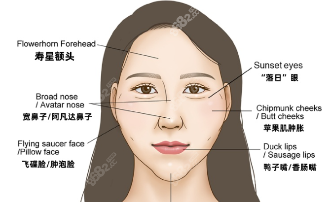 钟杰光修复馒化贵吗