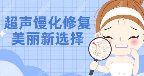 广州钟杰光修复馒化贵吗