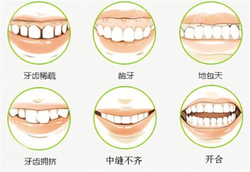 中诺口腔医院牙齿矫正价格表