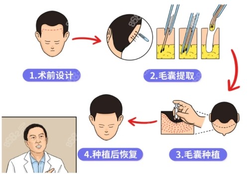 西安熙朵植发医院植发技术成熟